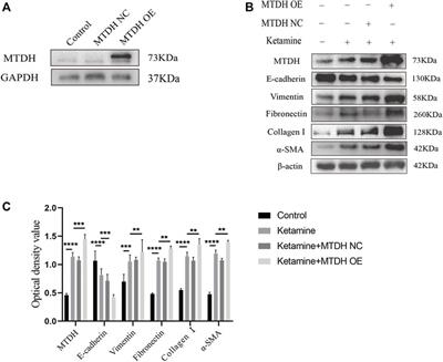 Ketamine Induced Bladder Fibrosis Through MTDH/P38 MAPK/EMT Pathway